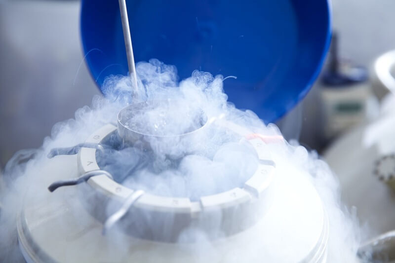 cryofreezing