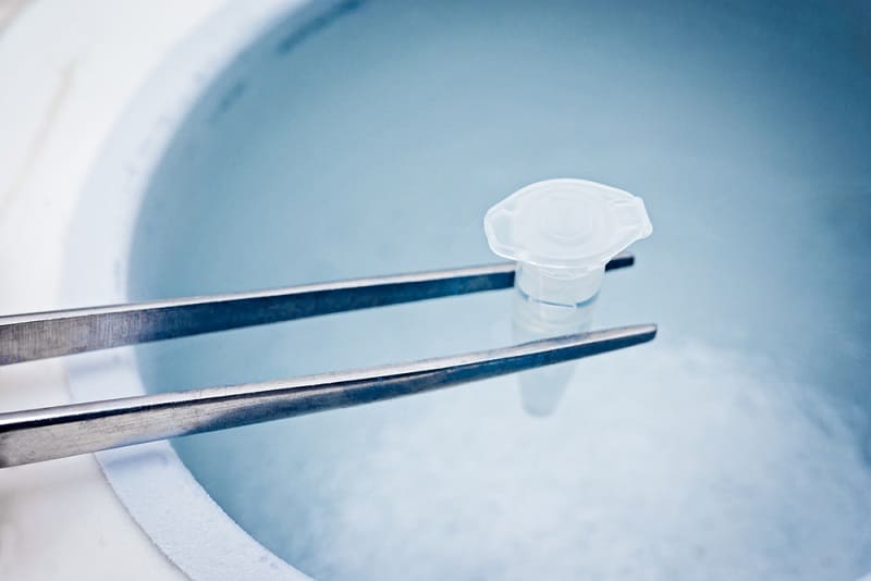 sperm freezing analysis