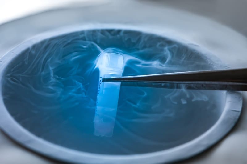 cryopreservation sperm