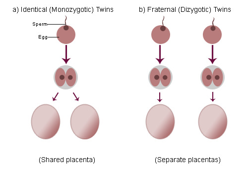 Diagram of Identical and Fraternal Twins Formation