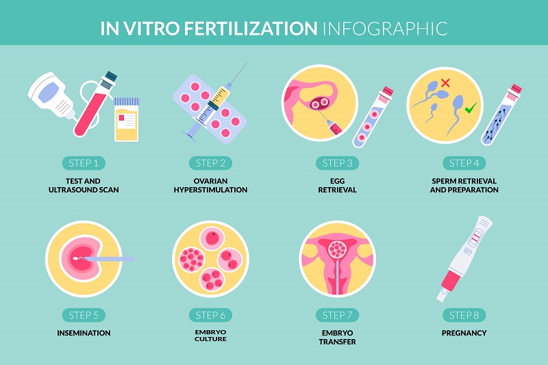 IVF Treatment