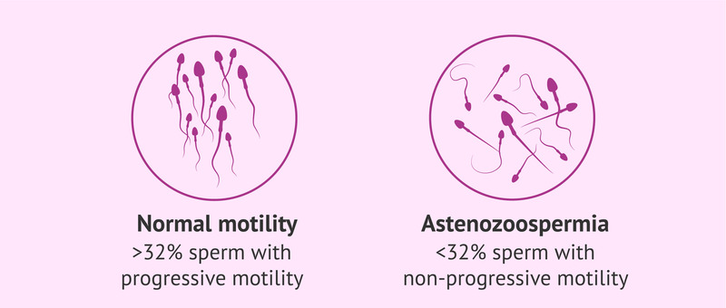 Comparison between normal sperm motility and asthenozoospermia, illustrating abnormal sperm movement