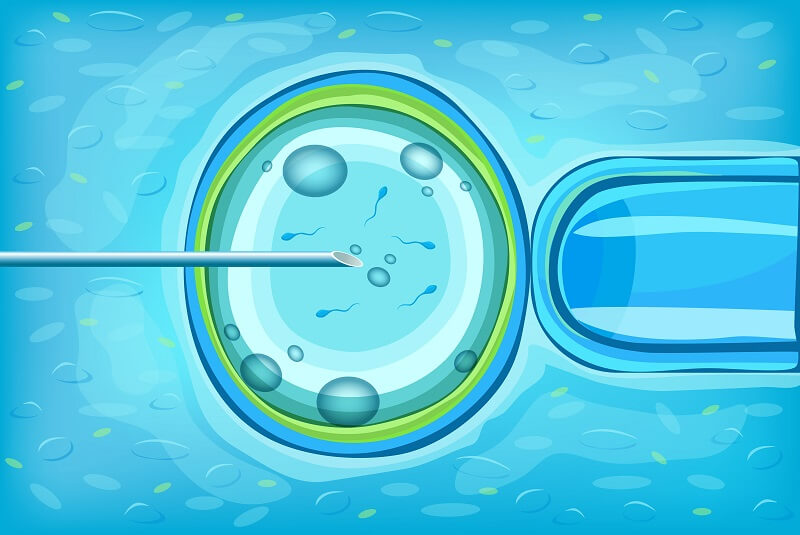 PCOS treatment using IVF