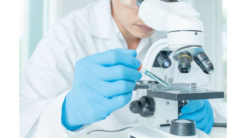 Causes of high sperm DNA fragmentation