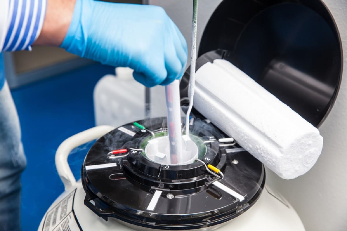 Sperm Freezing Cost in India (2025 Guide) – Price, Process & Tips
