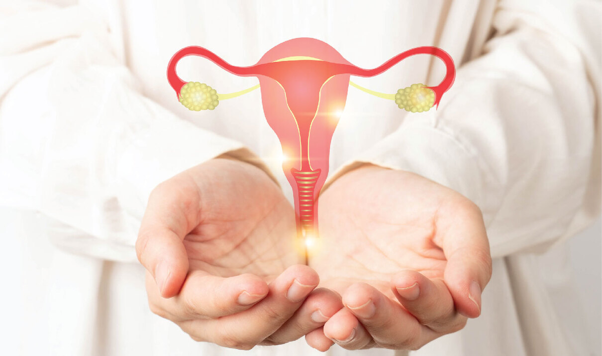 IUI