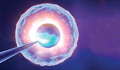 Laser Assisted Hatching