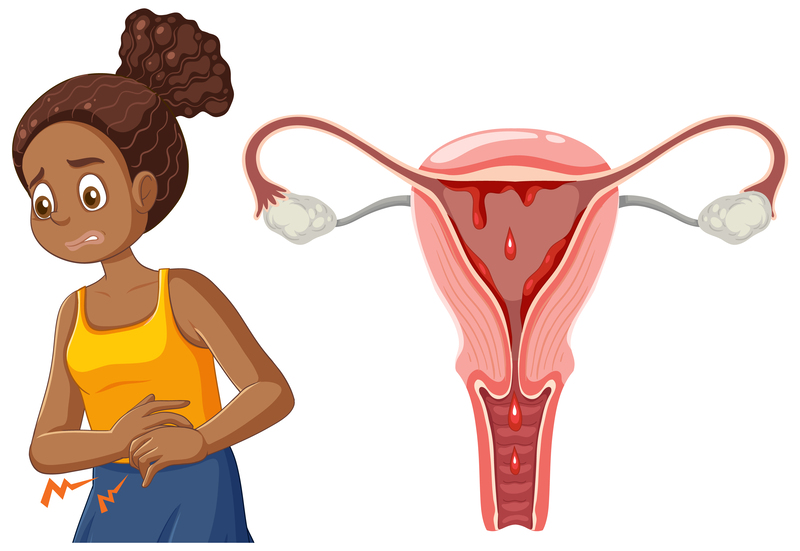 ovarian endometrioma symptoms